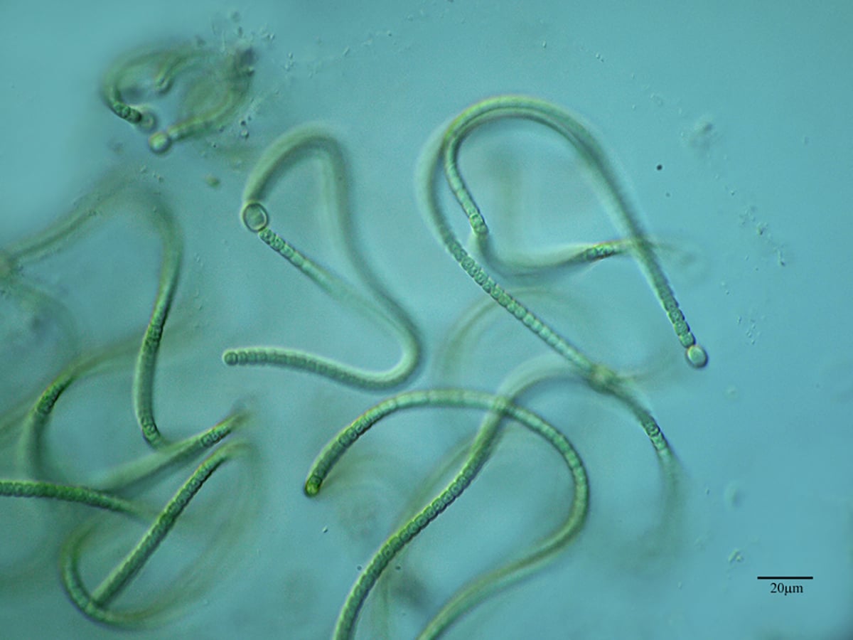 Cyanobacteria: What are they, where are they, benefits and harms